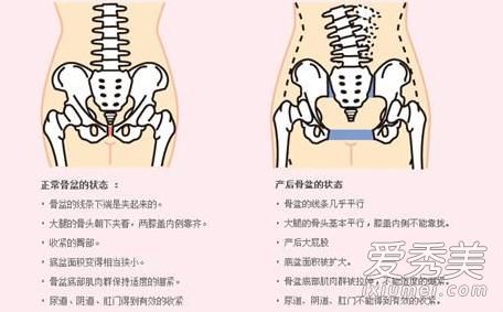 骨盆矫正带用多长时间 骨盆矫正带一天带多久